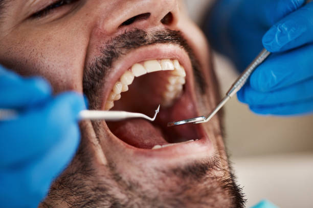 Best Emergency Dental Care for Broken or Chipped Teeth in Clintonville, WI