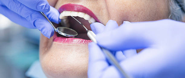 Best Emergency Treatment for Dental Infections or Abscesses in Clintonville, WI